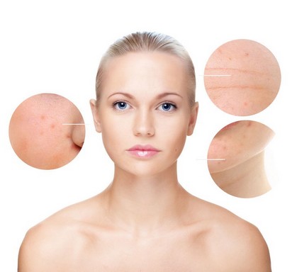 EGF-kezelés demonstrációja: női fej körül kör alakú minták a bőr különböző rétegeiből Két: EGF háttéranyag