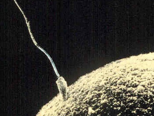 Spermium, Kép: wikimedia