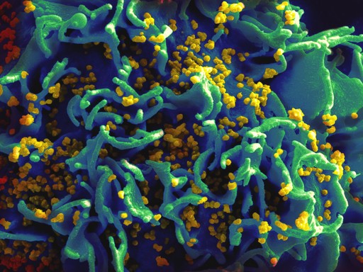 HIV-vírus, Kép: wikimedia